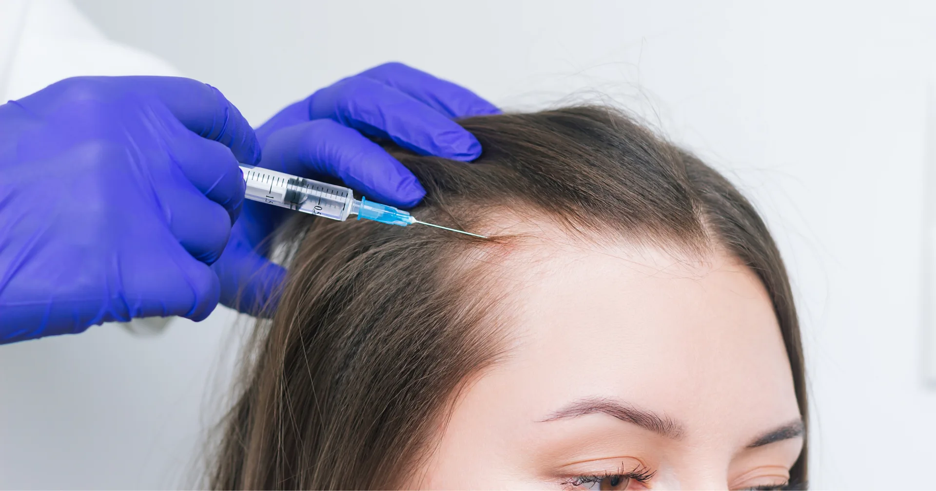 Clinician administering a scalp injection