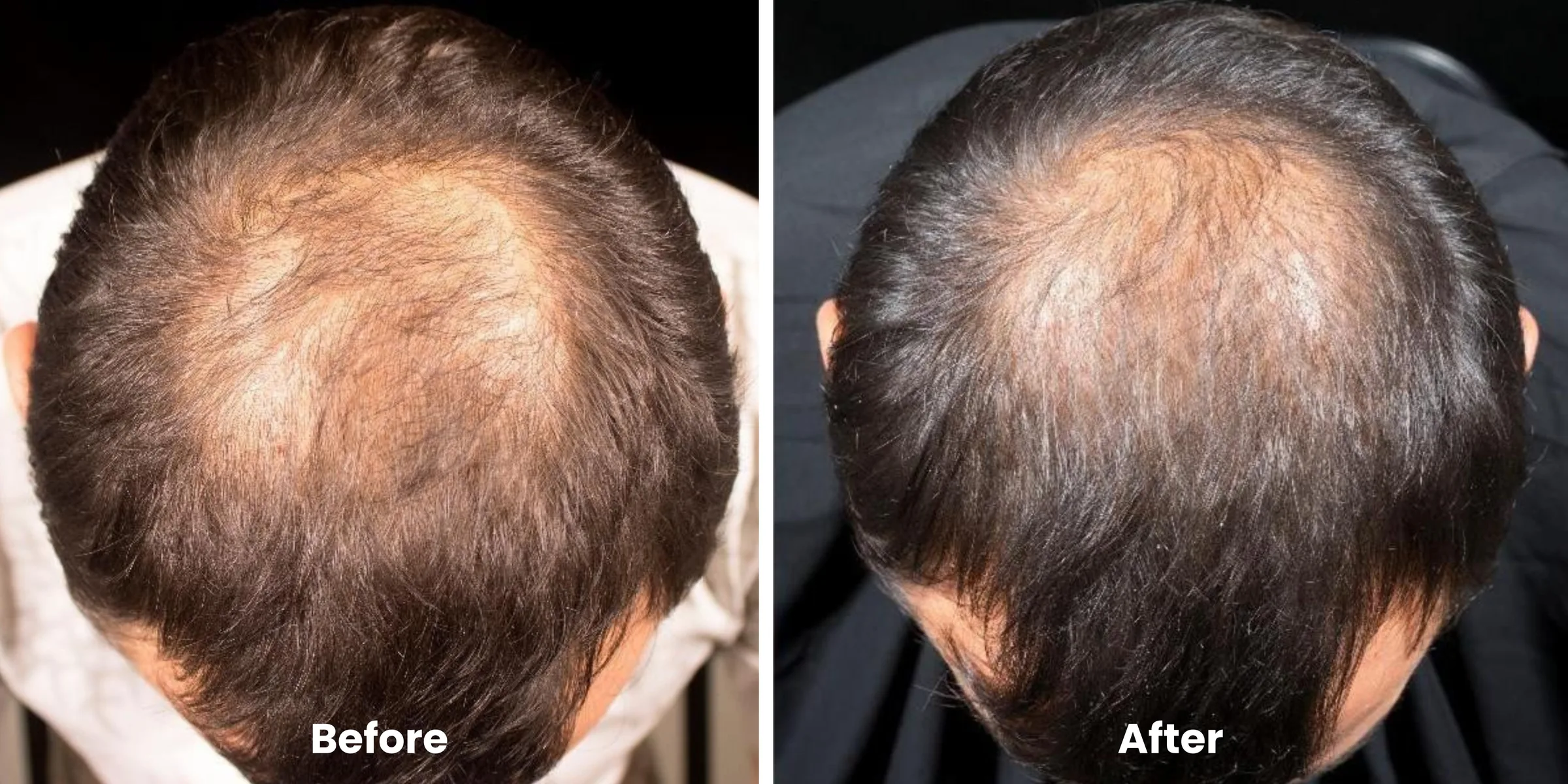 Elyara hair story clinical documentation image 01