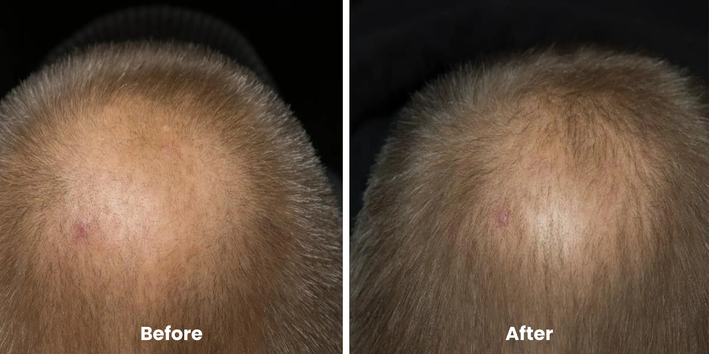 Elyara hair story clinical documentation image 10