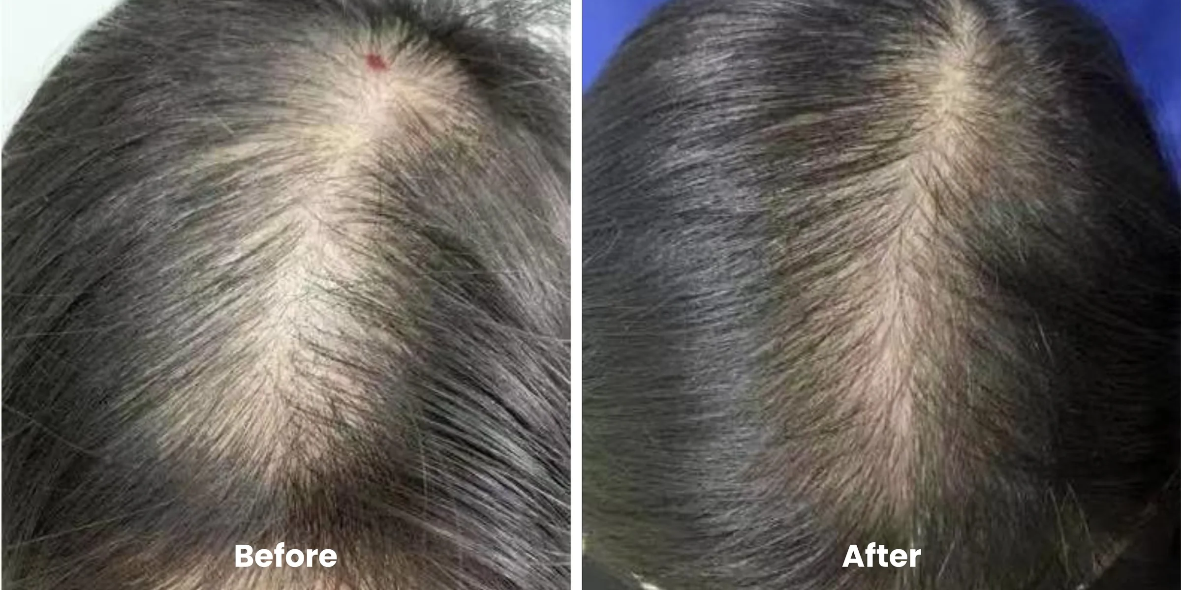 Elyara hair story clinical documentation image 11