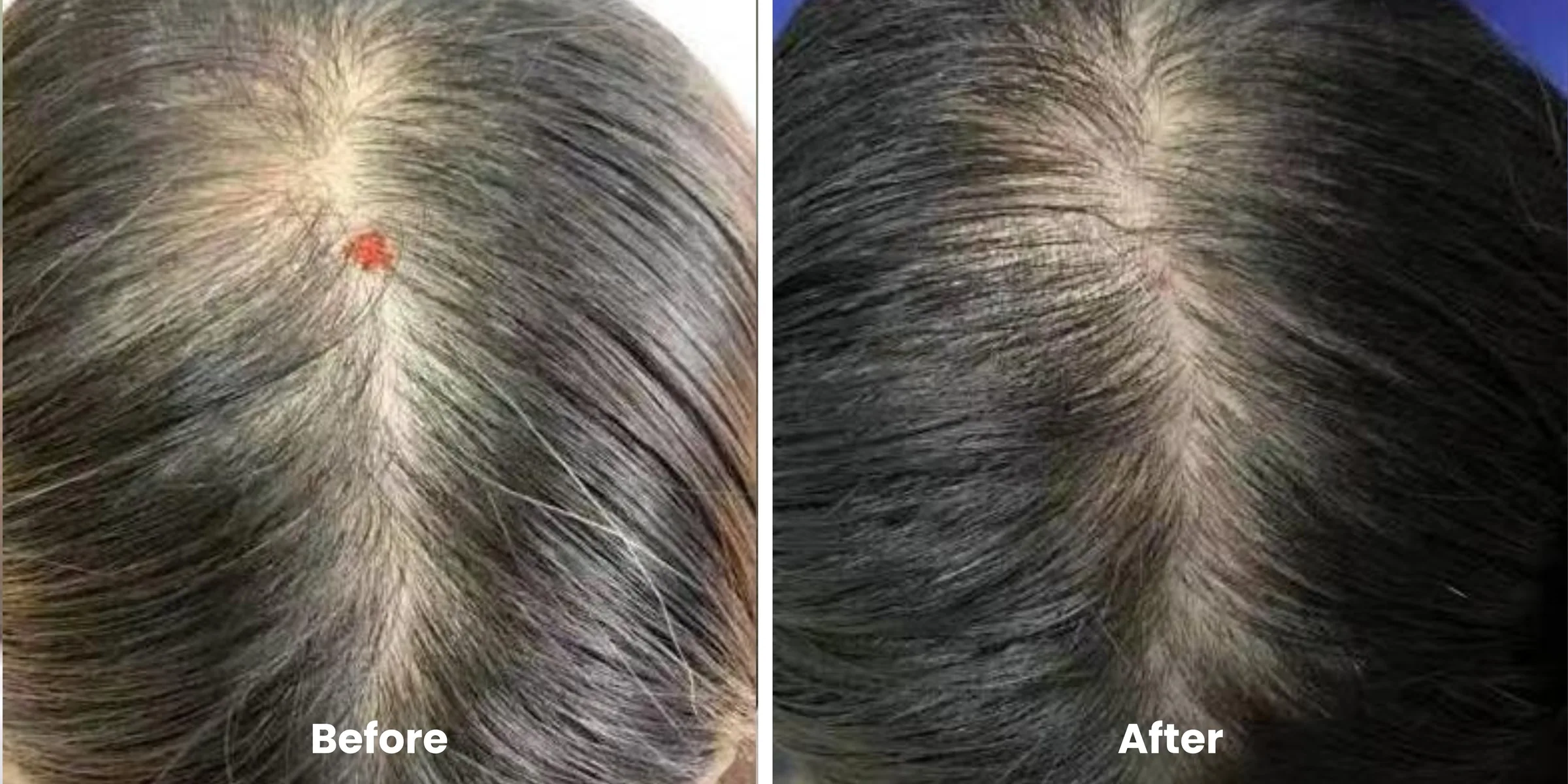 Elyara hair story clinical documentation image 12
