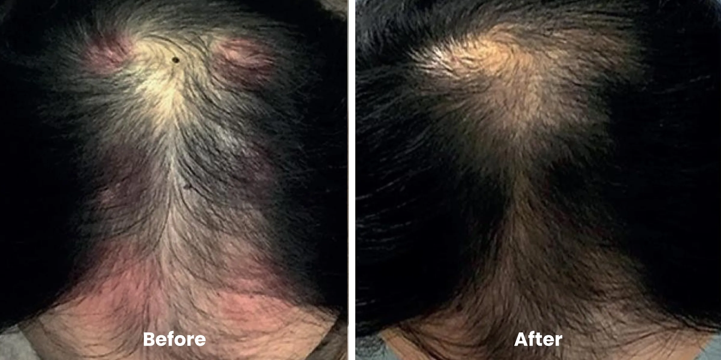Elyara hair story clinical documentation image 13