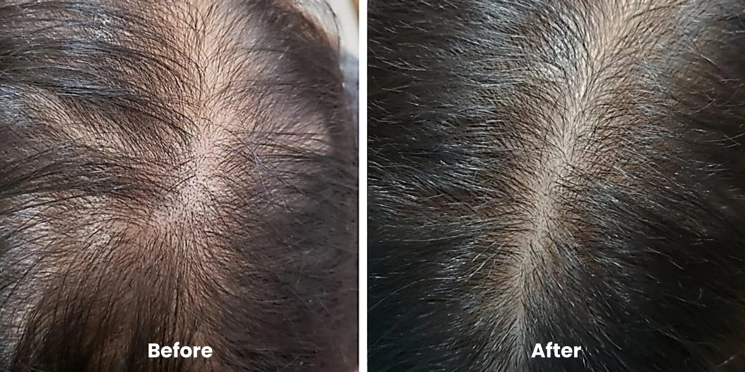 Elyara hair story clinical documentation image 14