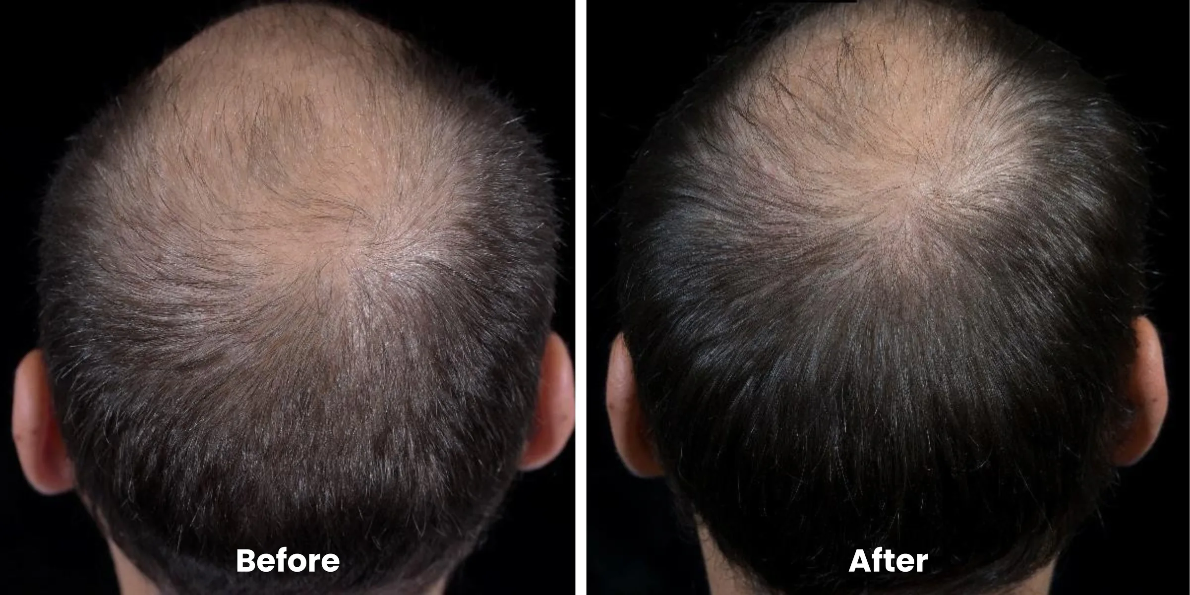 Elyara hair story clinical documentation image 02