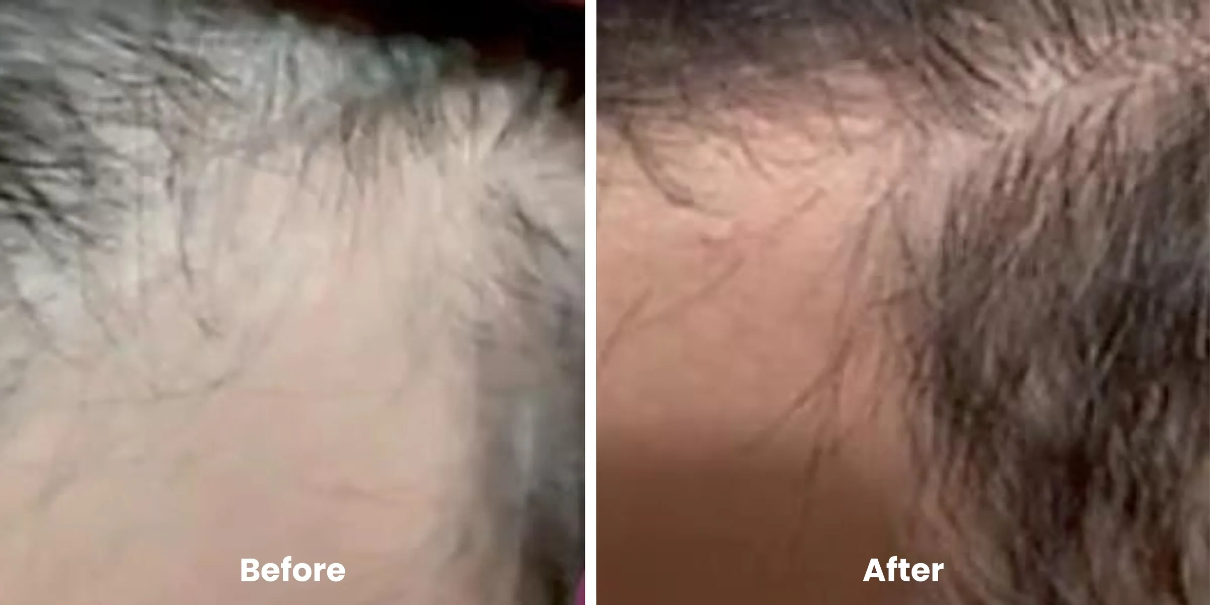 Elyara hair story clinical documentation image 05