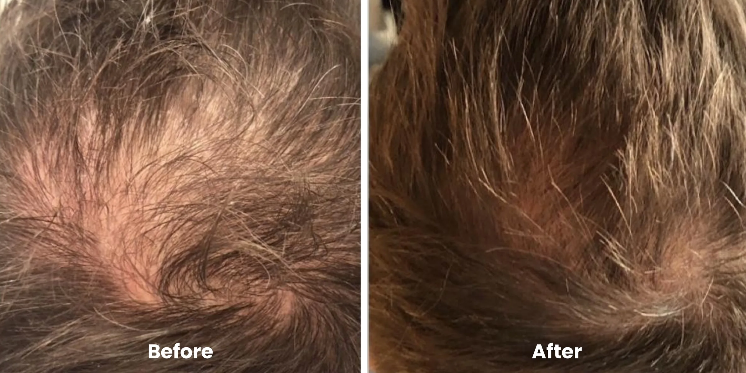 Elyara hair story clinical documentation image 06