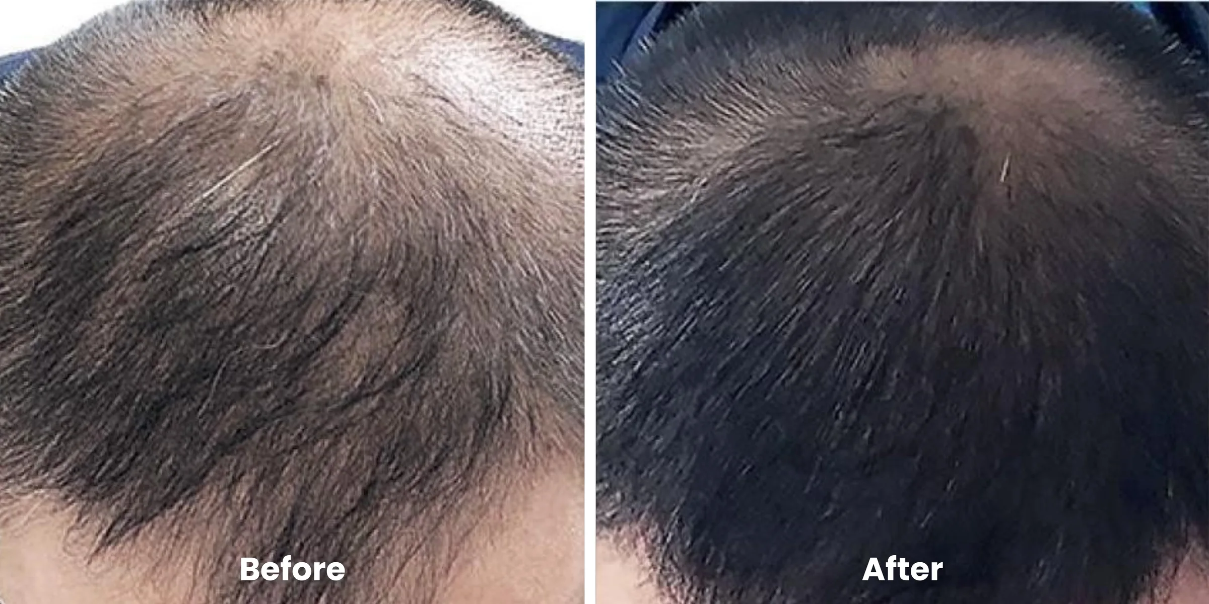 Elyara hair story clinical documentation image 07