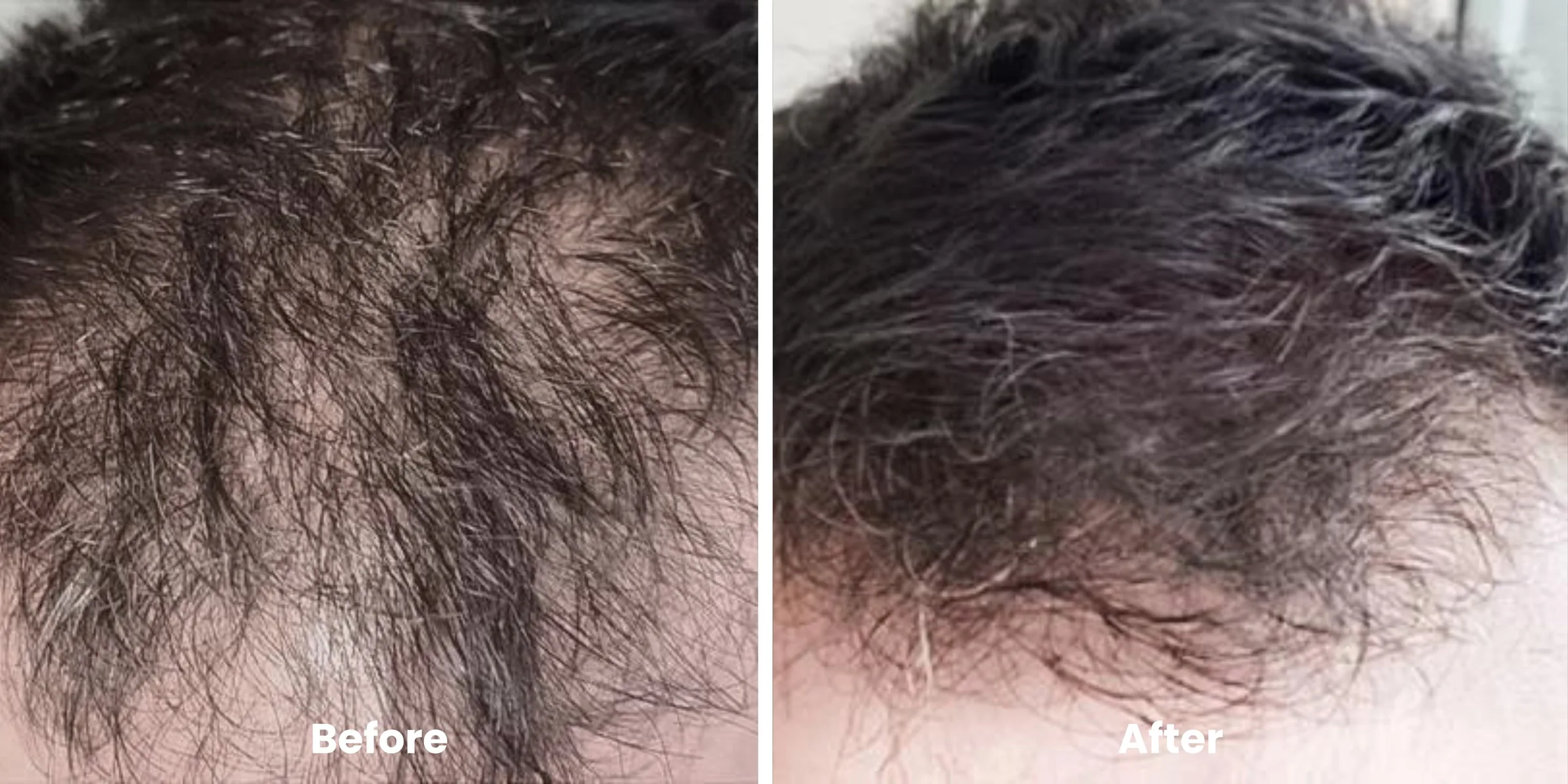 Elyara hair story clinical documentation image 08