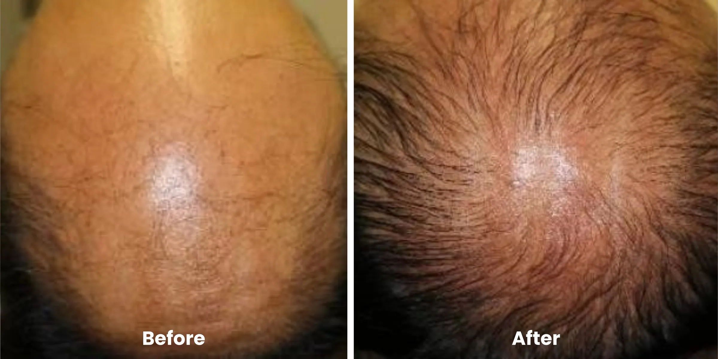 Elyara hair story clinical documentation image 09