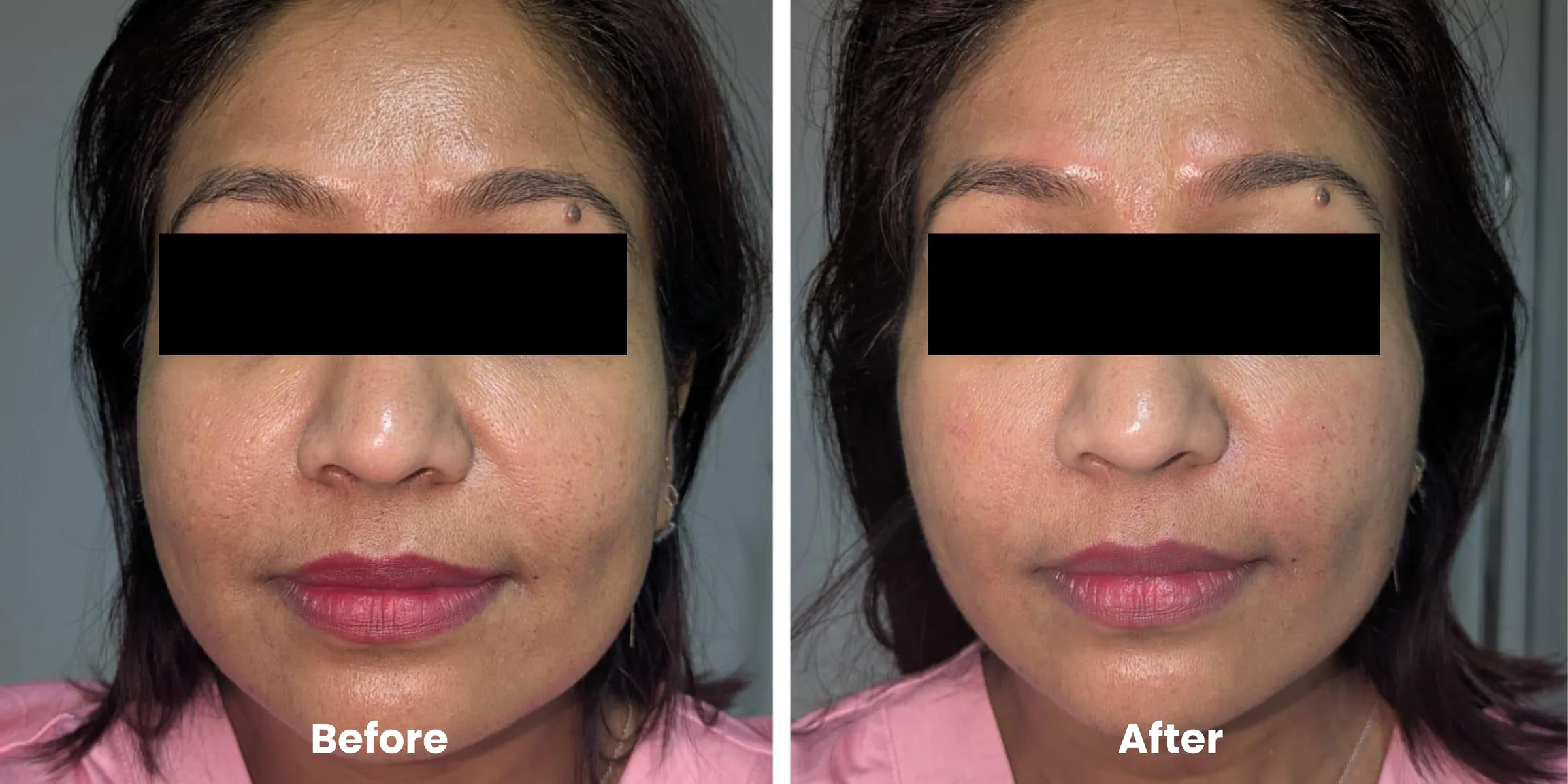 Elyara skin story clinical documentation image 01