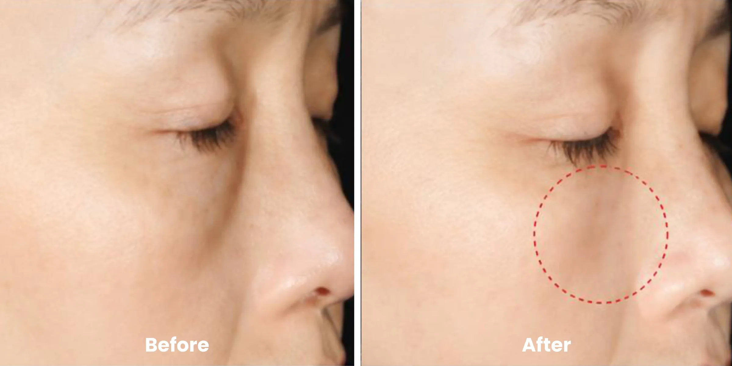 Elyara skin story clinical documentation image 02