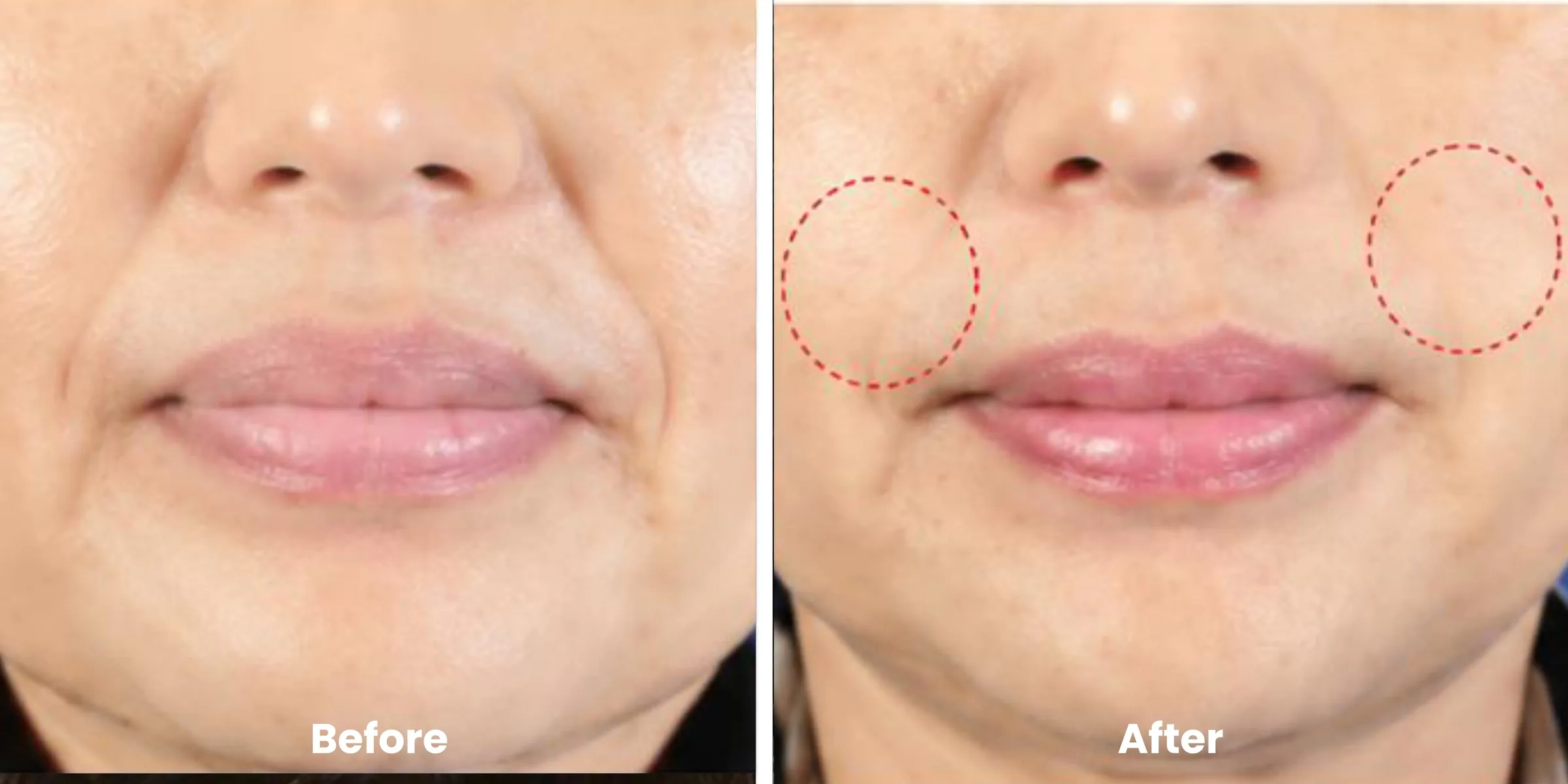 Elyara skin story clinical documentation image 03