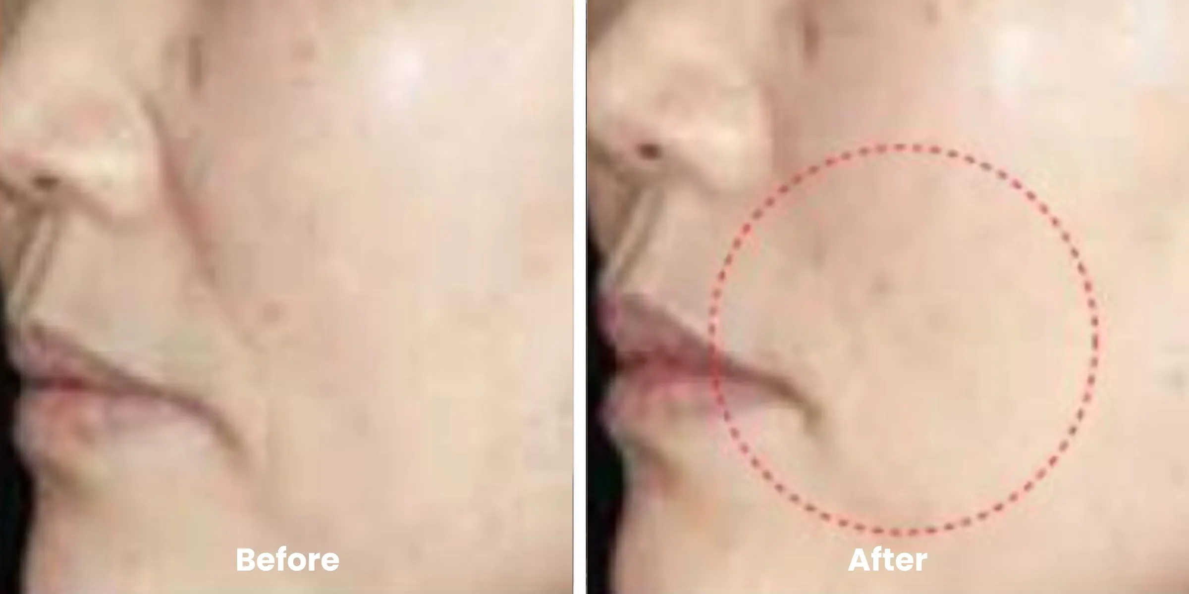 Elyara skin story clinical documentation image 04