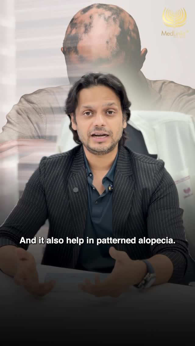 Hair filler doctor explanation video thumbnail